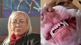 Екшън със 7-годишно дете и питбула на бивша даскалица във Враца, стопанката стояла безучастно и гледала нападението