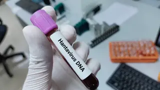 Френски пътник от круиза с хантавирус развил симптоми по време на евакуационен полет