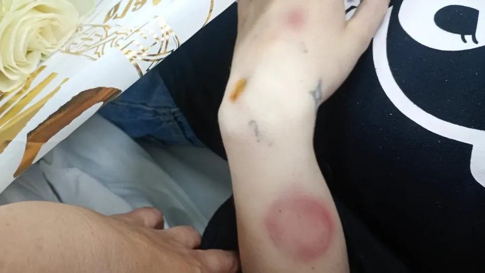 Случаят с 16-г. Ивана се заплита: Баща й показа снимки със следи от насилие