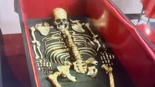 Нови разкрития за тежките болести, измъчвали цар Самуил