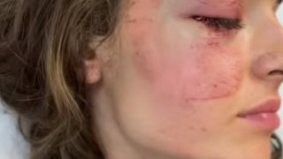Ужасна гледка: Млада българка посинена, всички изтръпнаха! ВИДЕО/СНИМКИ 18+