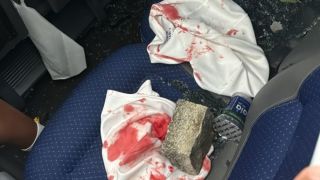 Ужасяващо! Атакуваха и окървавиха играл в ЦСКА и Лудогорец ВИДЕО 18+