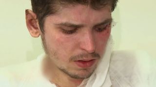 Оцелелият по чудо Светльо шокира с разкритие след 10 операции ВИДЕО
