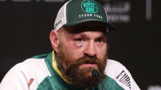 Голяма бомба за световноизвестен боксьор! ВИДЕО