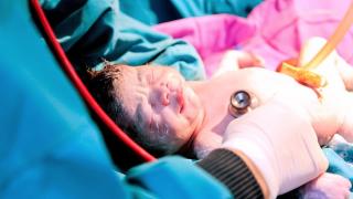 "Бавното" цезарово сечение ли ще е новия хит в раждането?