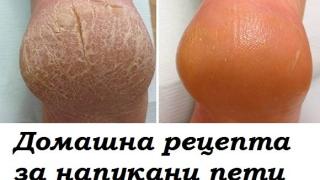 Как да се отървем от напуканите пети? Безотказна рецепта!