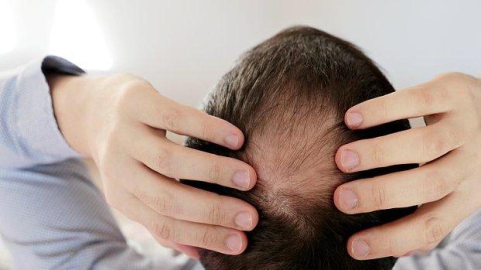 Пенисът на мъж се сви и деформира заради хапчета за борба с плешивостта