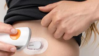 Полагат ли ми се сензори Dexcom при диабет тип 1?