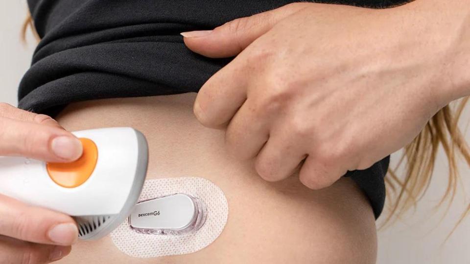 Полагат ли ми се сензори Dexcom при диабет тип 1?