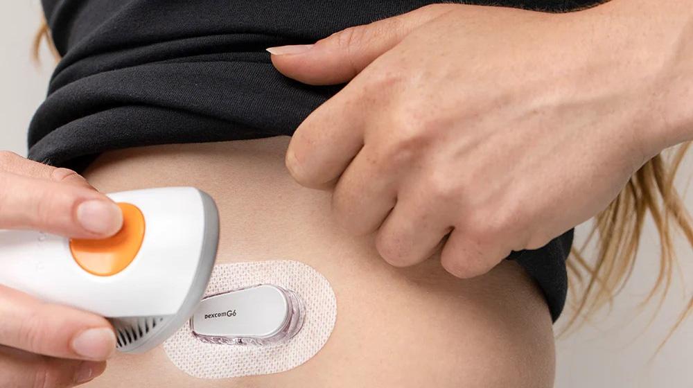 Полагат ли ми се сензори Dexcom при диабет тип 1?
