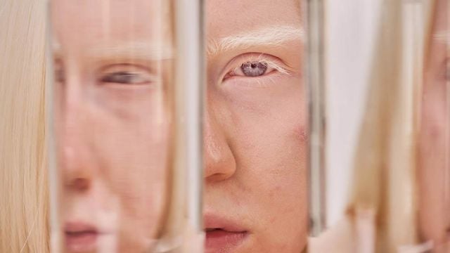 Безцветен поглед – що е то