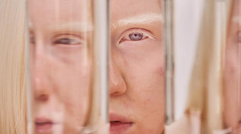 Безцветен поглед – що е то