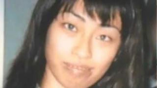 Момиче легна под ножа за 300 операции, защото майка й й каза, че е грозна