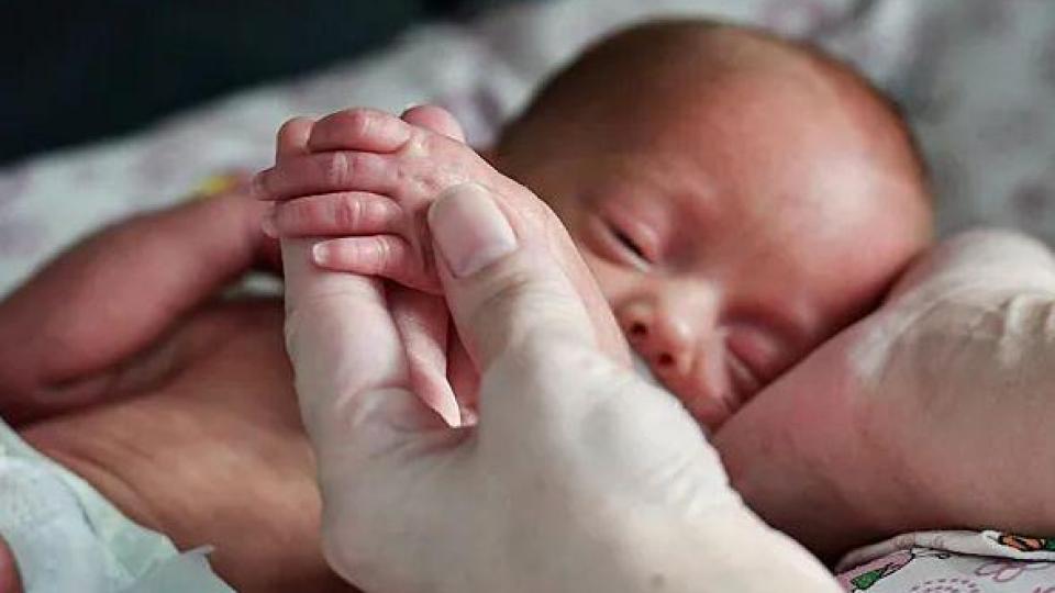 Лекари извадиха паразитен близнак с коса и крайници от корема на 2-м. бебе СНИМКИ 18+