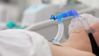 Необичаен постковид синдром превърна живота на млада жена в ад