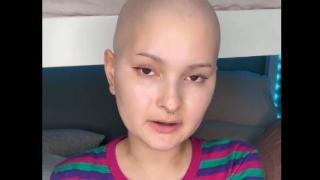 19-годишна със странно изтръпване на ръката се оказа с рядка форма на рак в трети стадий