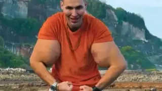 Инфлуенсърът, който инжектира масло в бицепсите си, отново е в болница! Вижте как изглежда сега