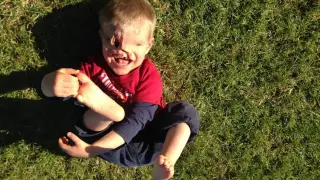 Чудото с "момчето без лице": Родителите го криеха, а днес, 10 години по-късно, е неузнаваем