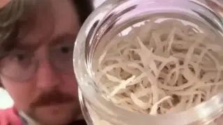 ТикТокър събира ноктите си в буркан от 6 години, но начинът, по който ги реже, е още по-гнусен