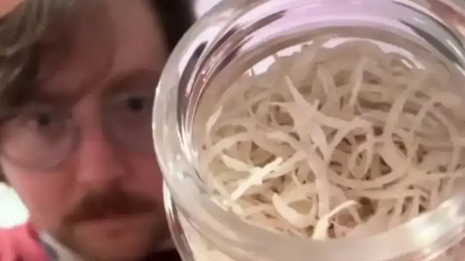 ТикТокър събира ноктите си в буркан от 6 години, но начинът, по който ги реже, е още по-гнусен