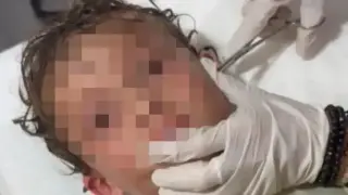 Кошмар за всеки родител: Лекари извадиха нещо ужасяващо от ухото на дете Видео