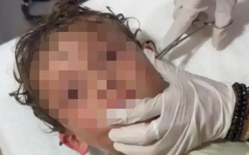 Кошмар за всеки родител: Лекари извадиха нещо ужасяващо от ухото на дете Видео