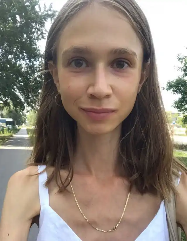 Трагедия в Бали: 27-годишна полякиня умира от екстремна плодова диета – тежала едва 23 килограма