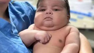 Жена роди 6,5 кг. бебе по нормален път, а после...