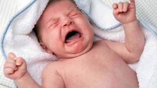 Шок: Откриха близнак паразит с крайници и пъпна връв в корема на новородено