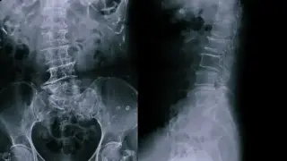 Мъж се оплаквал от силни болки в стомаха – лекарите онемели от откритието