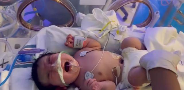 Медицинска сестра влезе в болница заради 9-кг. киста, но по време на операцията лекарите се натъкнаха на...