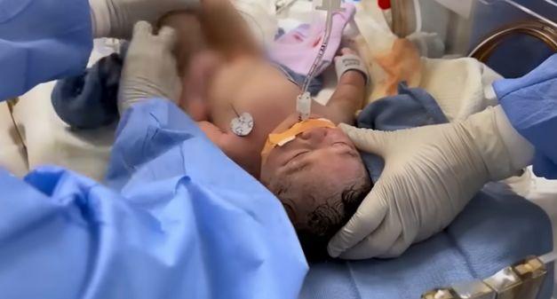 Медицинска сестра влезе в болница заради 9-кг. киста, но по време на операцията лекарите се натъкнаха на...