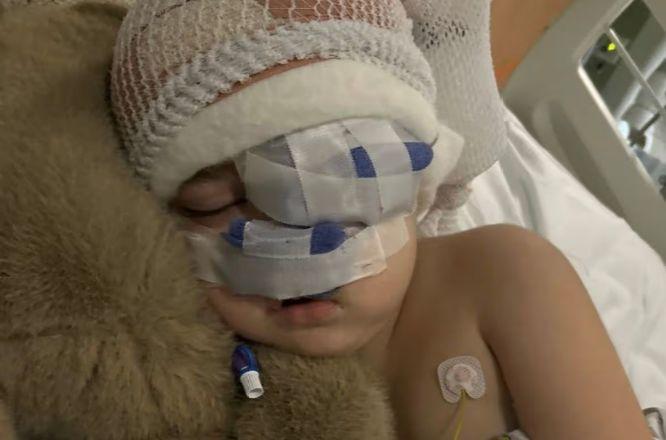 Момче с с око, подуто до размера на топка за голф, изненада лекарите