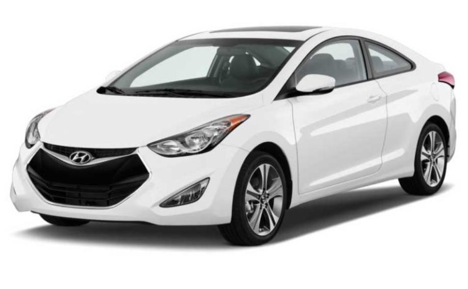 Тези модели на Hyundai получиха отрицателни оценки за надеждността им Снимки