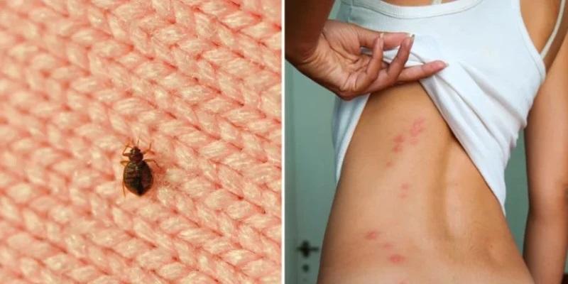 Жители на страна в Европа са предупредени за нашествие на безсмъртни дървеници