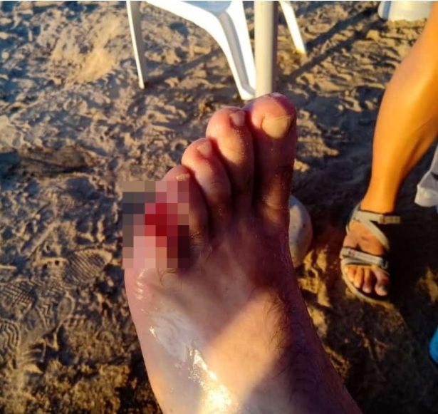 Най-малко 40 плажуващи са ранени при ужасяващо масово нападение от пирани 18+