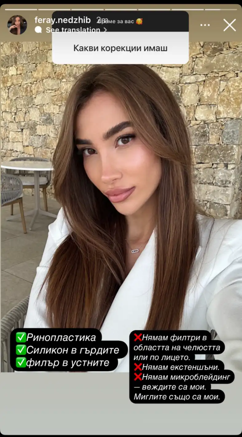 Ферай от "Ергенът" призна за силикона и... СНИМКИ