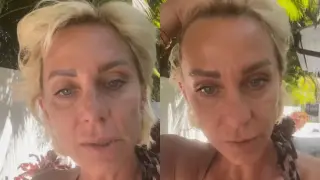 Нана Гладуиш още бори сериозните поражения по лицето си ВИДЕО