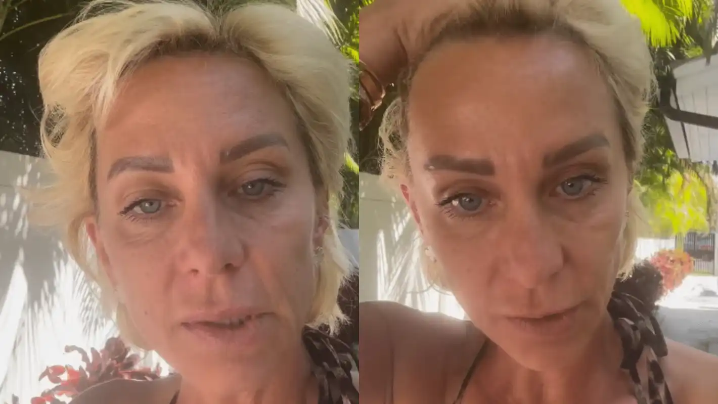 Нана Гладуиш още бори сериозните поражения по лицето си ВИДЕО