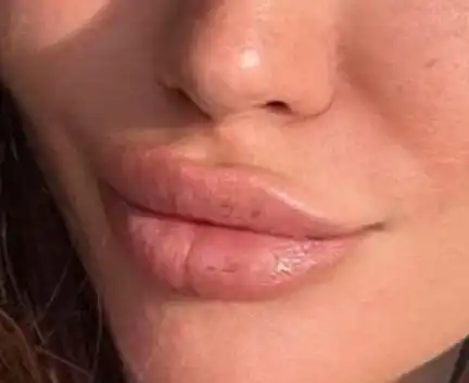 Щерката на Фатик се съблече и изплаши всички с липсата на гърди Снимки