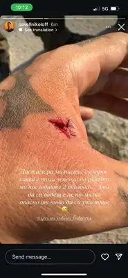 Водещият на "Игри на волята" Павел показа окървавена ръка, пострадал е тежко на терен Снимка