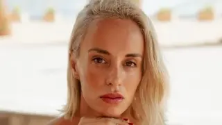 Радина Кърджилова пак напомпа устните си