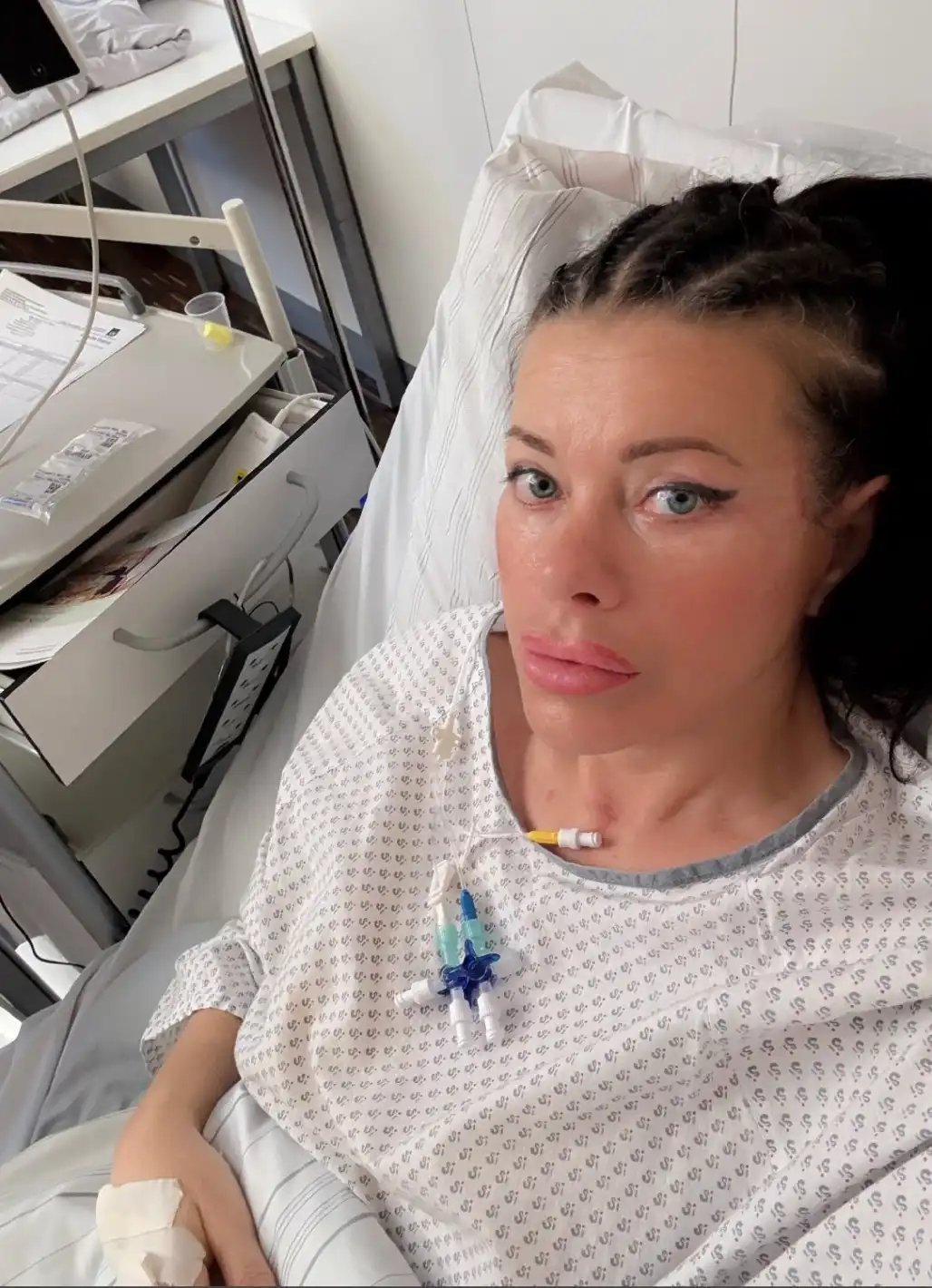Тежка операция: Изрязаха половината черен дроб на Меги Дерм Видео