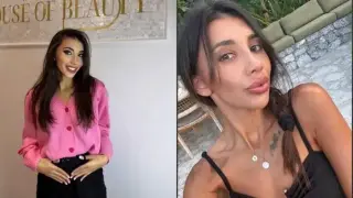 Виктория от "Ергенът" си махна хиалурона, неузнаваема e Снимка