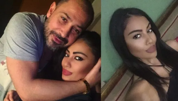 Под ножа на 16? Щерките на звездите са неузнаваеми след корекциите