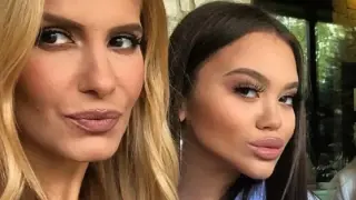 Под ножа на 16? Щерките на звездите са неузнаваеми след корекциите