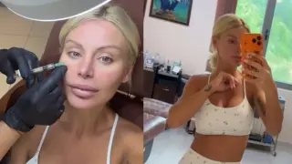 Светлана Василева разказа за подмладяваща процедура с ДНК от сьомга